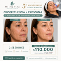 Criofrecuencia + exosomas
