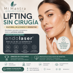 Tratamiento endolaser