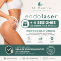Tratamiento endolaser (Preventa a precio exclusivo)