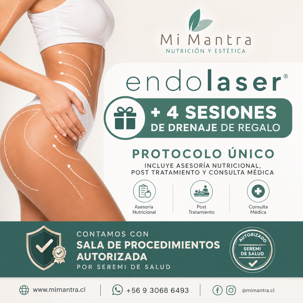 Tratamiento endolaser (Preventa a precio exclusivo)
