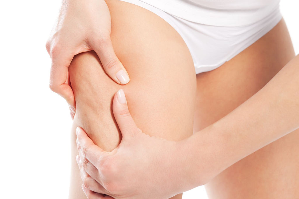 Tratamiento 10 sesiones anti celulitis y/o Lipedema + nutrición ortomolecular