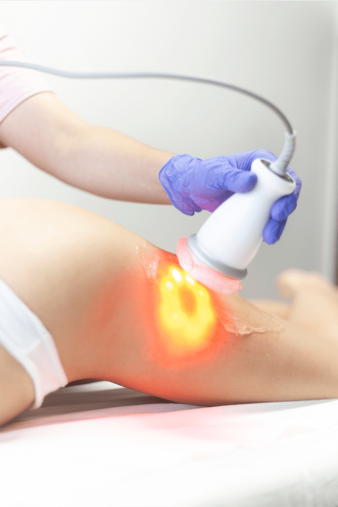 Pack full reductivo: 8 sesiones +  Nutrición