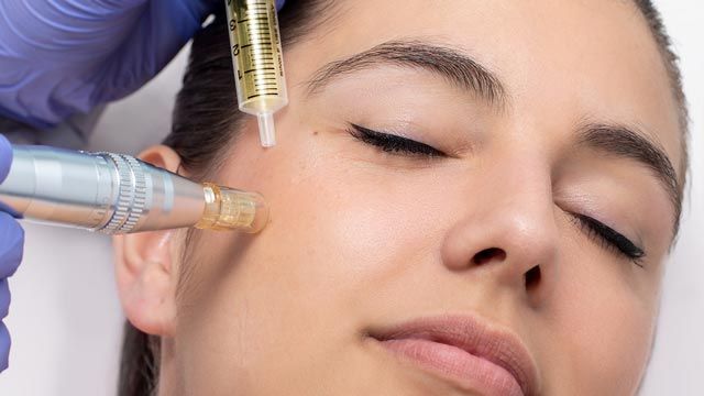 Microneedling