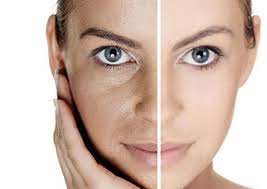 Rejuvenecimiento facial con Iontoforesis