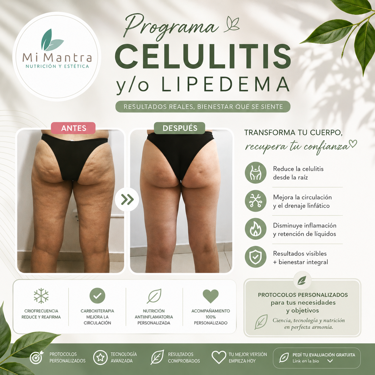 Tratamiento celulitis y/o lipedema 14 sesiones